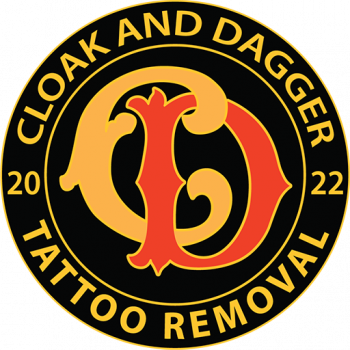 Cloak and Dagger Tattoo Removal